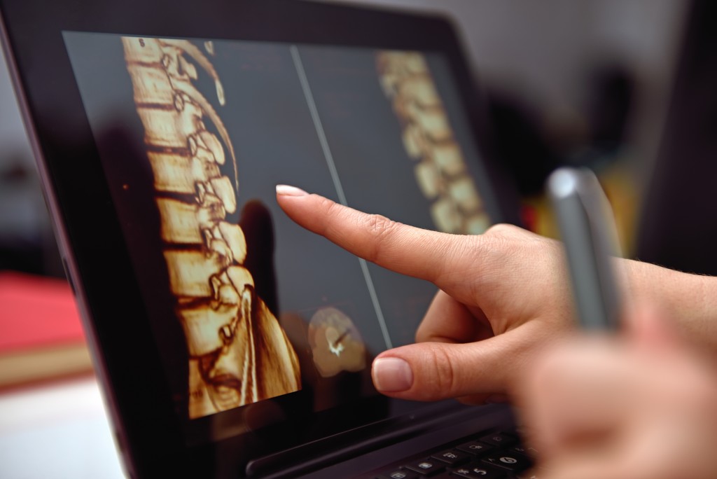 6 Simple Means to Take Care of Your Spinal Health