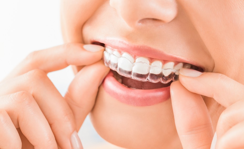 How to Get The Best Possible Results from Invisalign