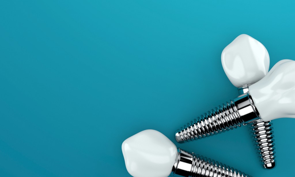 signs-that-you-need-a-dental-implant-redsave