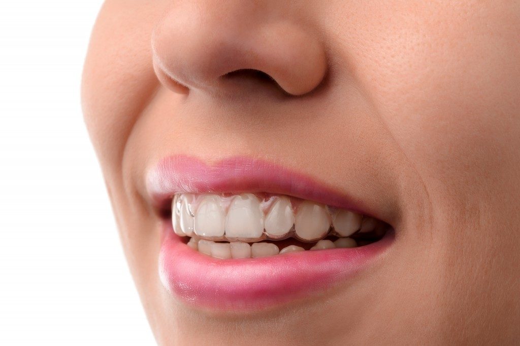 Woman talking with invisalign