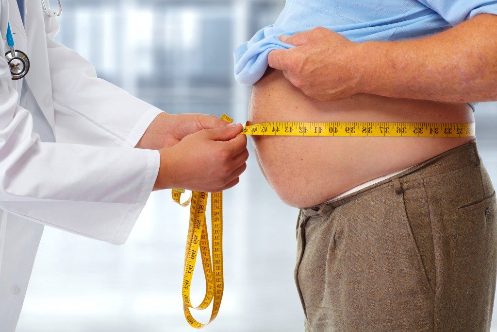 Doctor measuring obese man waist body fat