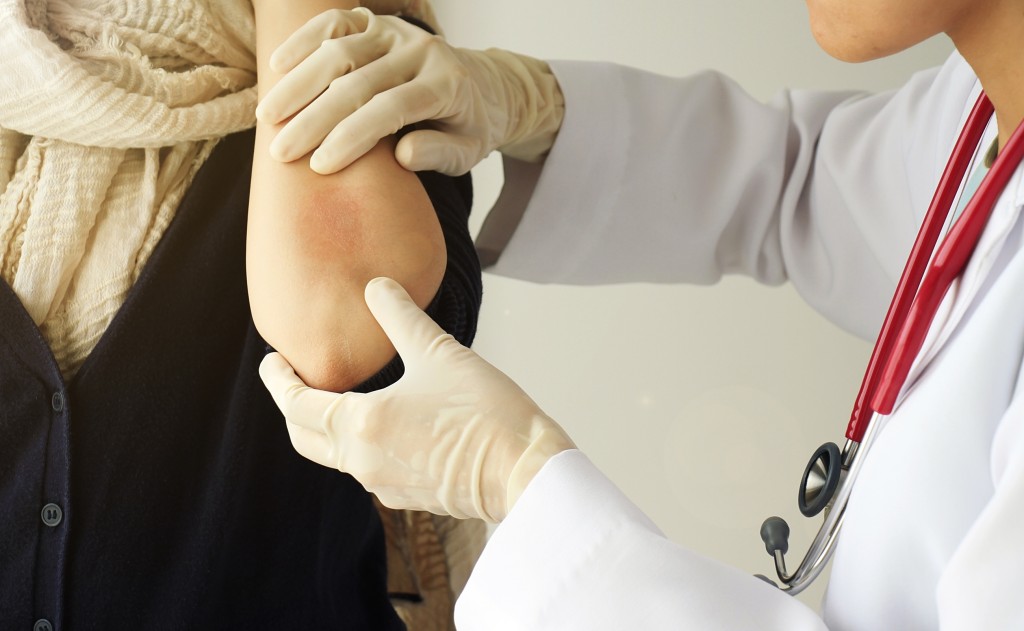 Dermatologist treating skin disorder