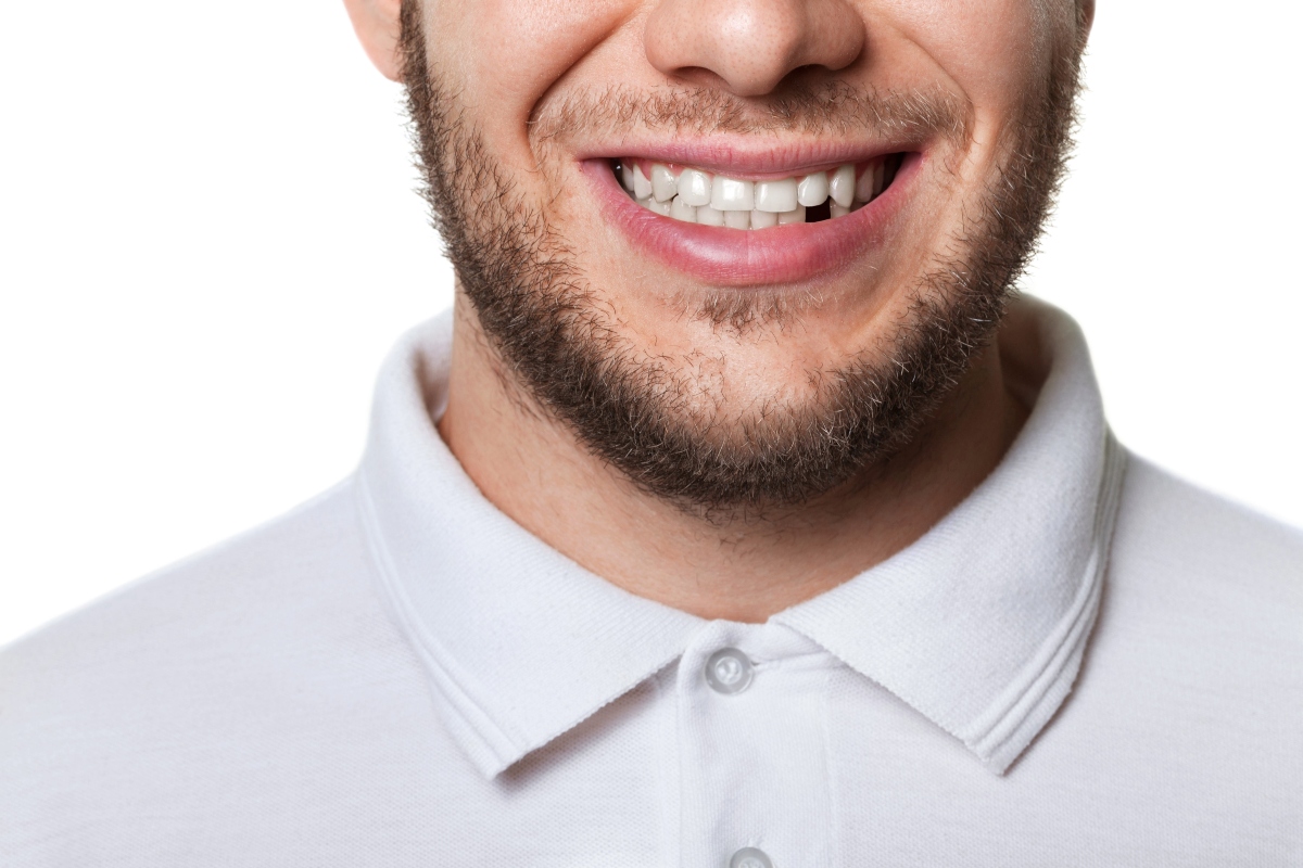 man with missing tooth