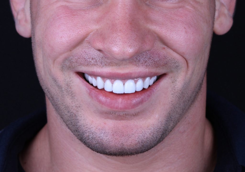man with white smile